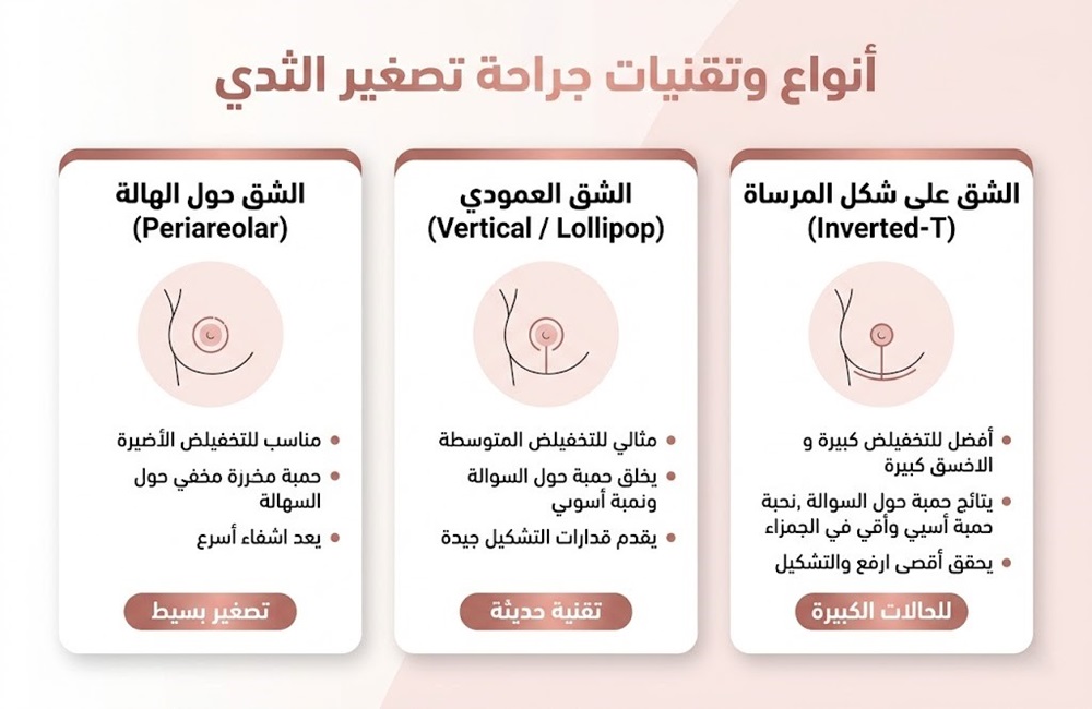 إنفوجرافيك تعليمي يشرح تقنيات جراحة تصغير الثدي في إيران من الحالات البسيطة إلى المعقدة مع سريتامد.