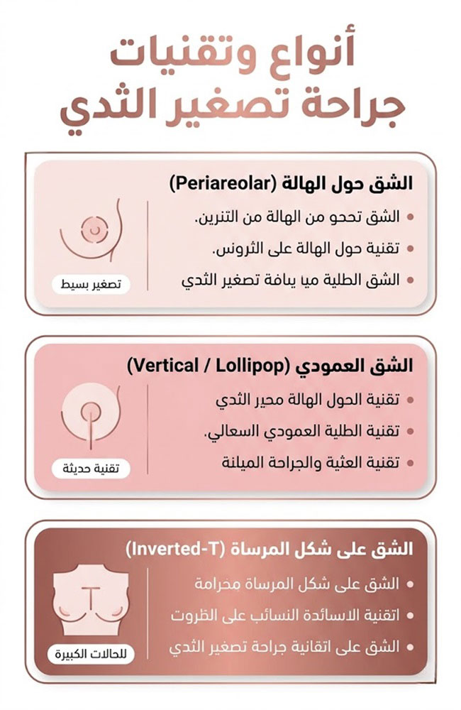إنفوجرافيك تعليمي يشرح تقنيات جراحة تصغير الثدي في إيران من الحالات البسيطة إلى المعقدة مع سريتامد.