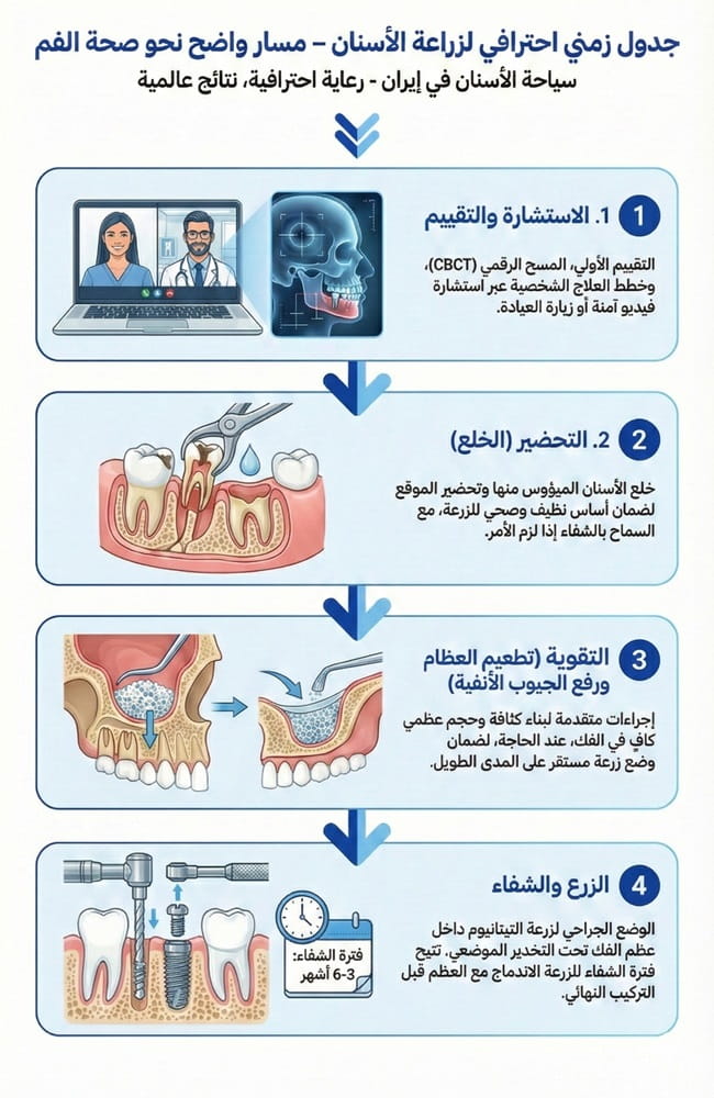 مراحل زراعة الأسنان في إيران: الاستشارة، التحضير، تطعيم العظام، والزرع الجراحي.