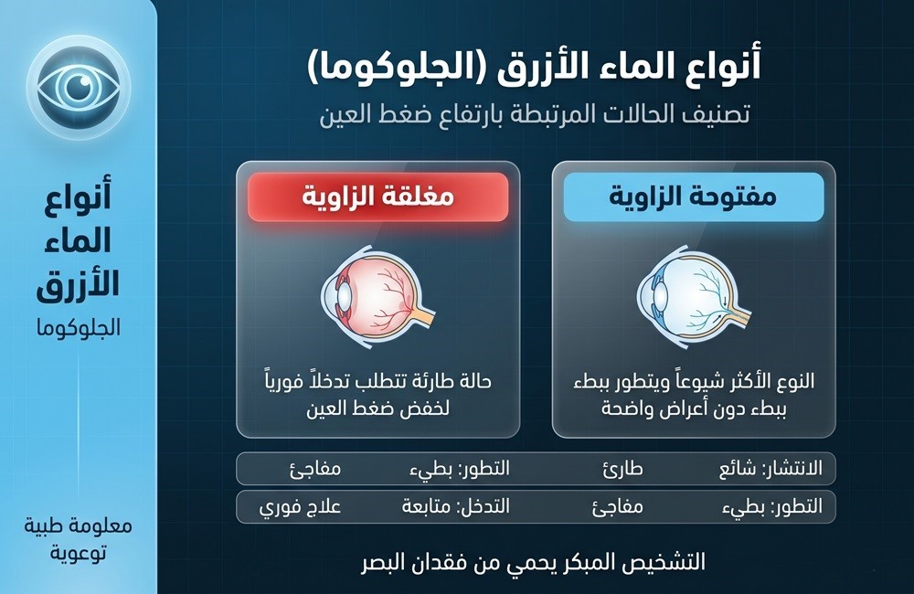 إنفوجرافيك يشرح أعراض الماء الأزرق (الجلوكوما) وعوامل الخطورة التي تؤدي لارتفاع ضغط العين.