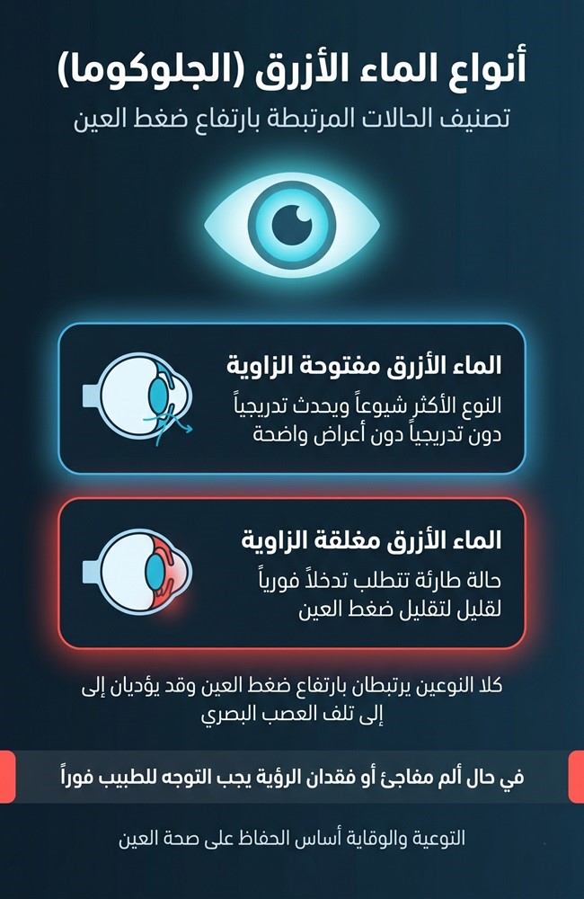 إنفوجرافيك يشرح أعراض الماء الأزرق (الجلوكوما) وعوامل الخطورة التي تؤدي لارتفاع ضغط العين.