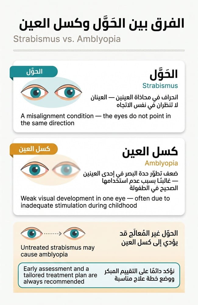 إنفوجرافيك يوضح الفرق بين الحول (Strabismus) وكسل العين (Amblyopia) ويؤكد على أهمية التقييم المبكر لعملية الحول في إيران لدى سريتامد.