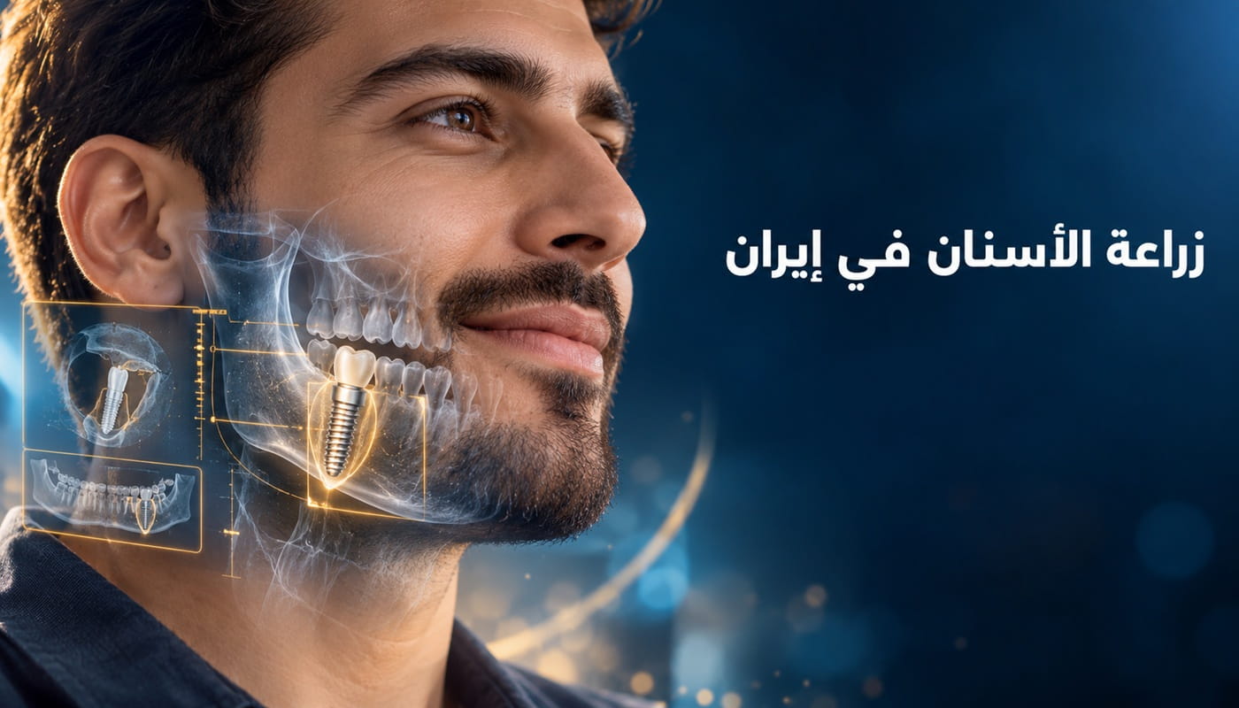 زراعة الأسنان في إيران مع تصوير رقمي للفك يوضح غرسة من التيتانيوم وتاجاً خزفياً ضمن التخطيط الحديث للزراعة.