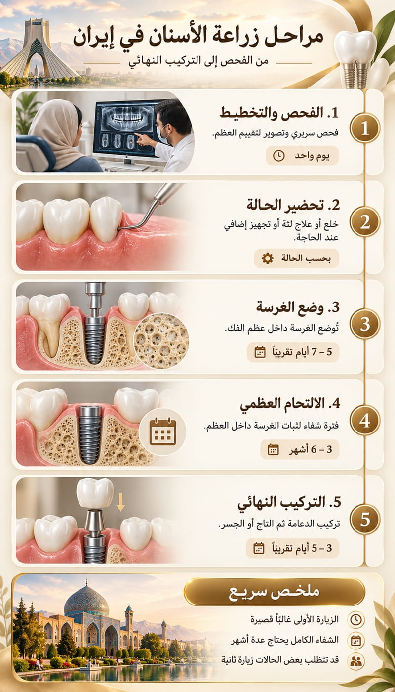 إنفوغرافيك عمودي يوضح مراحل زراعة الأسنان في إيران من الفحص والتخطيط حتى وضع الغرسة والالتحام العظمي والتركيب النهائي.
