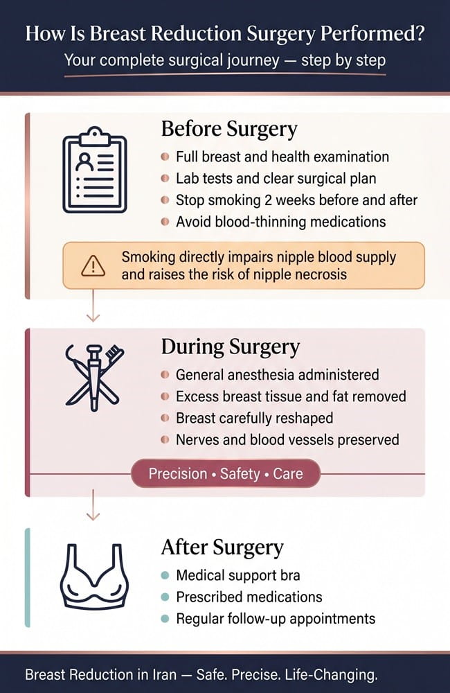 Infographic showing the step-by-step process of breast reduction surgery in Iran including before surgery, during surgery, and recovery stages.