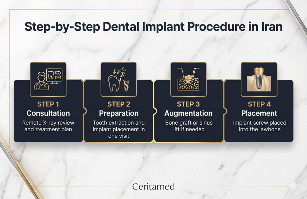 Infographic showing the 4 steps of dental implant procedure in Iran: Consultation, Preparation, Augmentation, and Placement by Ceritamed.