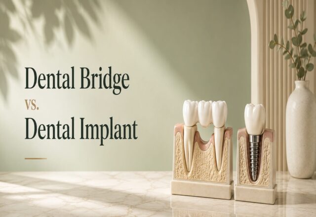 Dental Bridge vs. Dental Implant
